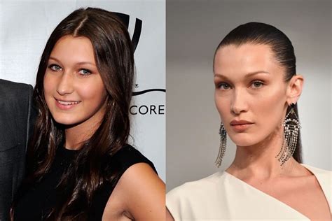 bella hadid young|bella hadid before surgery.